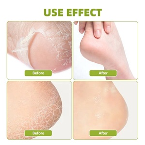 OEM/ODM 2-Step Foot Skin Care Hidratante <span class=keywords><strong>Crema</strong></span> Menta Desodorante Exfoliante y <span class=keywords><strong>Crema</strong></span> Exfoliante <span class=keywords><strong>para</strong></span> Adultos - Product Image 4