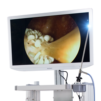 Système d'endoscopie vidéo de définition de bon prix avec la meilleure qualité Endoscope SonoScape UHD
