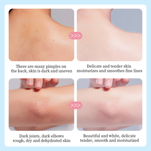 OEM para Marca Privada, Crema Corporal Vegana, Herbal, Natural, Blanqueadora e Iluminadora de Rosa, Aguacate y <span class=keywords><strong>Mango</strong></span> - Product Image 4