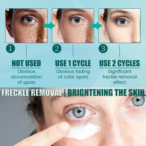 Crème éclaircissante et anti-taches avec propriétés hydratantes et anti-rides, crème raffermissante pour le soin de la peau, 20g - Product Image 6