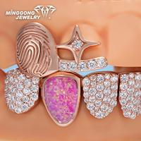 Grillz ouverts personnalisés plaqués or rose et argent, avec détails empreinte digitale, accents de pierres précieuses colorées, pierres latérales en opale rose, et partie inférieure entièrement pavée de pierres.