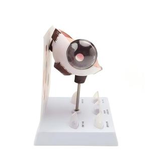 Modelo Anatómico <span class=keywords><strong>del</strong></span> <span class=keywords><strong>Ojo</strong></span> Humano Ampliado con 5 Tipos de Lentes Patológicas de Catarata para la Enseñanza de Oftalmología - Product Image 2