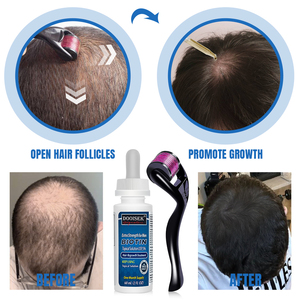 Nouveau Sérum Capillaire Bio Kirland 5% à Base de Plantes Naturelles, Traitement Essentiel Contre la Chute des Cheveux et pour la Croissance des Cheveux à la Biotine, pour Femmes Noires - Product Image 3