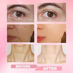Bâton de baume crème contour des yeux teinté anti-rides OEM acide hyaluronique organique saumon pour réparer la peau des yeux nourrissant soulagement des <span class=keywords><strong>cernes</strong></span> - Product Image 3