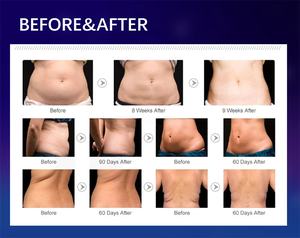 First Choice 3 en 1, 24 Presiones de Aire, Reducción de Grasa, Drenaje Linfático, Pérdida de Peso, Alivio del Dolor - Product Image 5