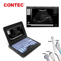 CONTEC CMS600P2-VET physique thérapie par ultrasons échographes