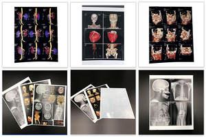 Satılık iyi fiyat Pe medikal <span class=keywords><strong>Film</strong></span> Rolls beyaz tıbbi <span class=keywords><strong>x-ray</strong></span> <span class=keywords><strong>Film</strong></span> için mürekkep püskürtmeli <span class=keywords><strong>Fuji</strong></span> tıbbi kuru <span class=keywords><strong>Film</strong></span> - Product Image 5