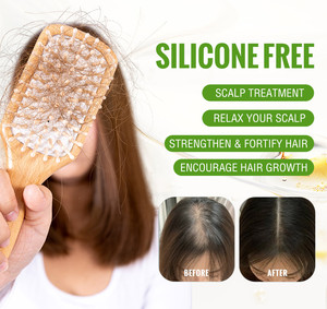 Champú a base de hierbas de ginseng <span class=keywords><strong>para</strong></span> reducir <span class=keywords><strong>la</strong></span> pérdida de <span class=keywords><strong>cabello</strong></span> Champú de jengibre <span class=keywords><strong>para</strong></span> <span class=keywords><strong>la</strong></span> pérdida de <span class=keywords><strong>cabello</strong></span> - Product Image 4