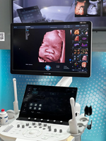 Ecógrafo Doppler Color 3D 4D SonoScape P80 ELITE de Alta Calidad con Software Profesional de IA para Hospitales y Clínicas
