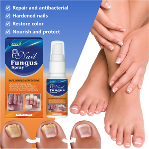 Soins des pieds, herbes naturelles chinoises, 30 ml, meilleur traitement pour les infections fongiques des ongles des pieds et réparation des ongles fongiques - Product Image 4