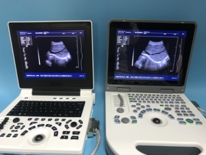 Hewan portabel murah menggunakan <span class=keywords><strong>ultrasound</strong></span> anjing kehamilan <span class=keywords><strong>ultrasound</strong></span> <span class=keywords><strong>laptop</strong></span> dokter hewan - Product Image 3