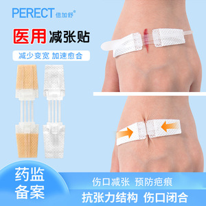 Dispositivo de sutura para heridas cutáneas Beijiashu, vendaje elástico tipo cremallera para reducción de cicatrices y cuidado de heridas - Product Image 2