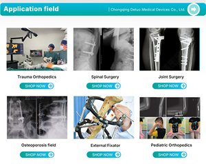 Fixador de Anel para Implantes Médicos, Fixação Externa Ortopédica para Tíbia e Fêmur - Product Image 5