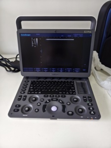 Ecógrafo Portátil Sonoscape E2 Pro con Doppler Color, Panorámico y Vis-Needle para Piezas Pequeñas y Punción Intervencionista - Product Image 2