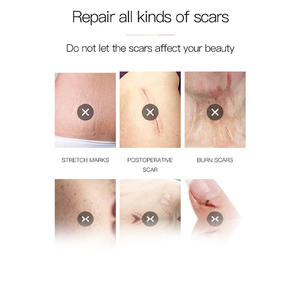 OEM قابل للتخصيص جل ندبة متقدم للندوب القديمة والجديدة إمدادات الرعاية الصحية المتقدمة - Product Image 3