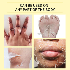 Etiqueta privada 110ml Extra fuerte Peeling Oil Scar Eliminar las estrías Blanqueamiento Yellow Peeling Oil - Product Image 6