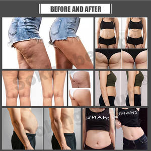 Sepatu bot Pressotherapy 8 chamders, perangkat pijat pemulihan Detox Pelangsing Badan kompresi udara drainase limfatik - Product Image 4