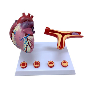 Modèle d'anatomie humaine du cœur : Équipement éducatif pour l'opération de rechange de l'artère coronaire et la thrombose vasculaire - Product Image 1
