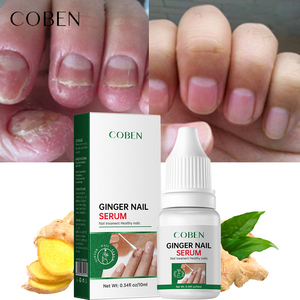 Tratamiento de uñas antiinfección de jengibre <span class=keywords><strong>COBEN</strong></span> para hongos en las uñas de los dedos cuidado de los pies y blanqueamiento brillante Dropshipping - Product Image 1