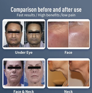 Meilleur traitement de la <span class=keywords><strong>cellulite</strong></span>, machine Venus Legacy 4D pour amincir, radiofréquence Venus Legacy 4D, perte de poids - Product Image 6