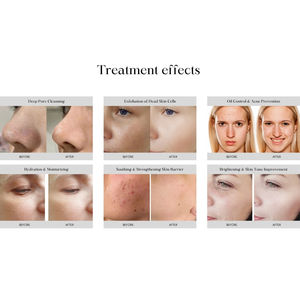 2025 más Popular Hydra Microdermabrasion Rejuvenecimiento <span class=keywords><strong>DE</strong></span> LA PIEL Estiramiento facial Cuidado <span class=keywords><strong>DE</strong></span> LA PIEL Máquina multifunción Hydra - Product Image 6