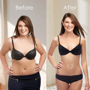 Masajeador de eliminación de celulitis adelgazante eléctrico portátil 6 en 1, dispositivo facial y corporal para perder peso y belleza - Product Image 3