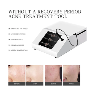 OEM ODM Personal Care Equipment Sonic Acne Treatment Skin Whitening Beauty Machine - Product Image 3