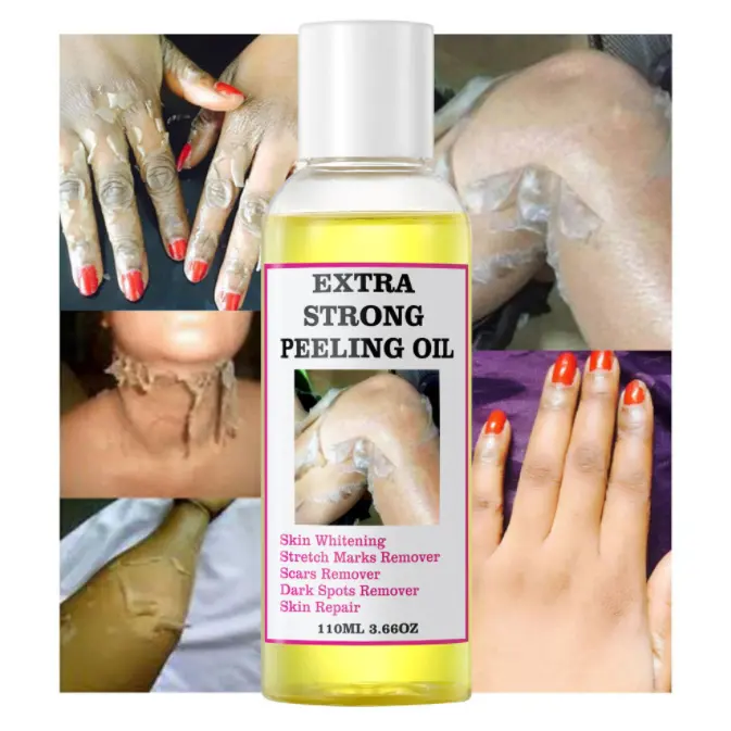 Rimozione del correttore delle macchie scure pelle morta sbiancamento delle nocche più efficace per rimuovere la pelle morta esfoliante olio Peeling all'arancia