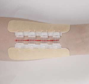 อุปกรณ์ปิดแผลฟิล์ม <span class=keywords><strong>PET</strong></span> แบบใช้แล้วทิ้งอุปกรณ์ป้องกันแผลที่ผิวหนัง - Product Image 5