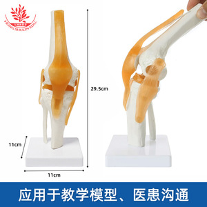 Modèle articulaire humain avec quatre types de ligaments (épaule, pied, genou, hanche), détaillé et clair, un modèle médical orthopédique standard - Product Image 4
