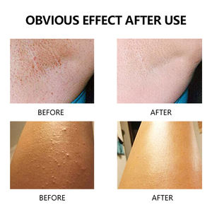 Huile de poils incarnés de marque privée pour apaiser les bosses des aisselles des poils incarnés bosses du rasoir produit après-rasage des rougeurs - Product Image 5