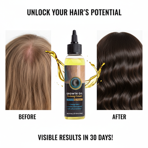 Aceite Capilar Vegano Orgánico Anticaspa de Tratamiento Profundo, Fortalece, Repara el Daño, Engrosa el Cabello y Previene la Caída del Cabello - Product Image 4
