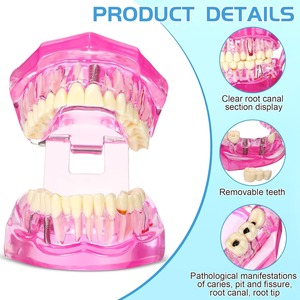 Modelo de Dientes para Implantes Dentales con Dientes Removibles, Demostración Patológica de Dientes Estándar para Dentistas, para Navidad - Product Image 4