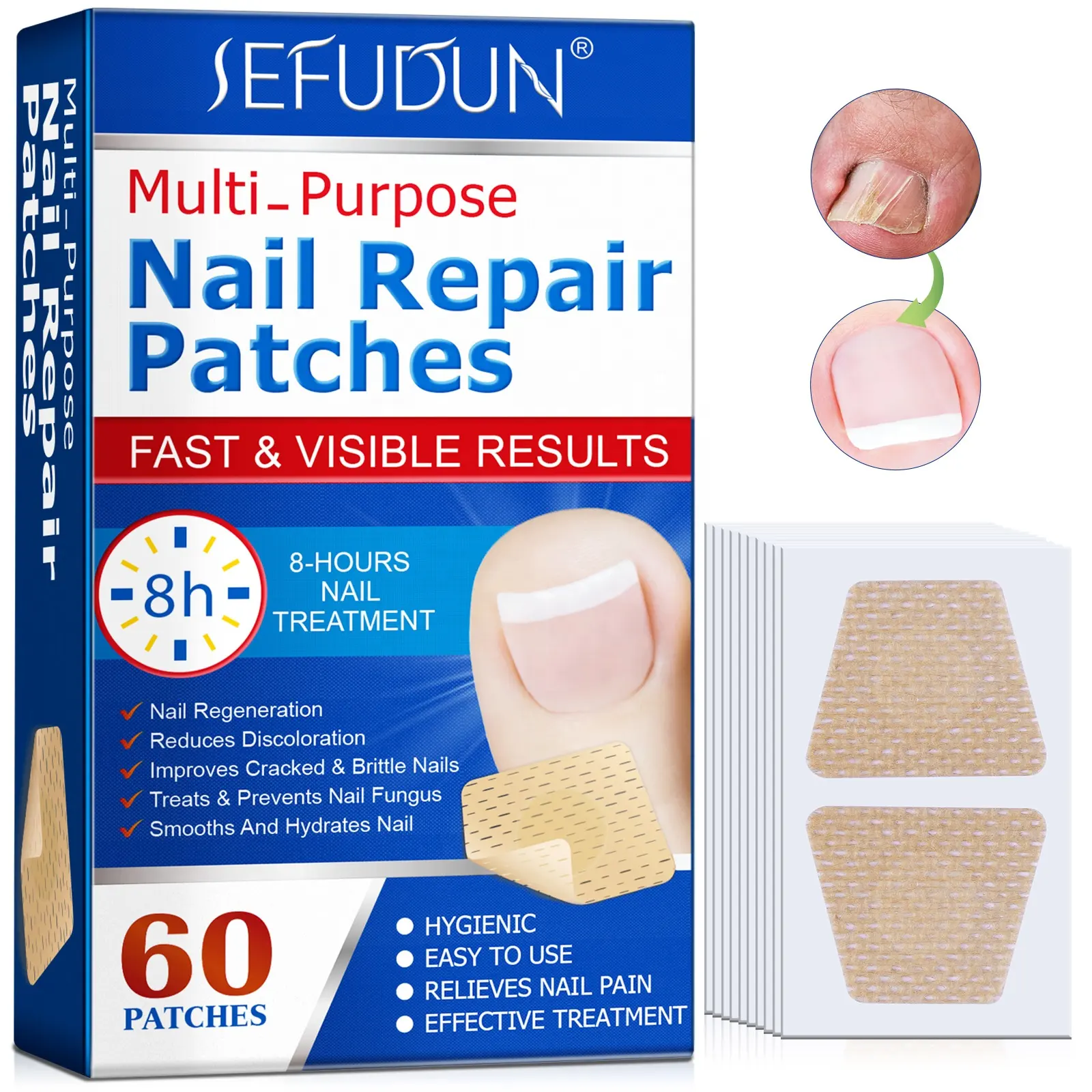 SEFUDUN fast effective moisten toe nail repair patch,treats prevents fungus ingrown nail correction patch,nail fungus patch