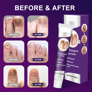 Extrait naturel de plante de marque privée crème <span class=keywords><strong>pour</strong></span> <span class=keywords><strong>les</strong></span> champignons des ongles réparation ongles abîmés nourrissant apaisant renforcer <span class=keywords><strong>les</strong></span> <span class=keywords><strong>mains</strong></span> brillantes soins des pieds - Product Image 6