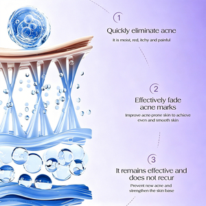 Crème éclaircissante personnalisée avec logo, crème hydratante pour le visage, crème anti-acné, crème anti-âge, crème éclaircissante pour <span class=keywords><strong>les</strong></span> <span class=keywords><strong>boutons</strong></span>, lotion pour le visage - Product Image 3
