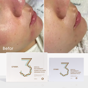 Maschera Viso in Foglio al Collagene Umano Ricombinante di Grado Medico per Cura Post-Procedura, Lenisce, Idrata e Illumina la Pelle Spenta - Product Image 2