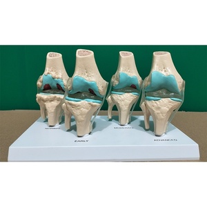 Material Didáctico Médico: Comparación de Patrones Normales y Patológicos para la Comunicación Médico-Paciente, Anatomía de la Articulación del Rodilla Humana - Product Image 1