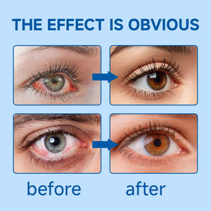 Clqq أفريقيا حار بيع الشاي الطبيعي مشرق الصينية العشبية تفتيح الشاي العين - Product Image 4