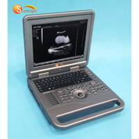 Système de diagnostic échographique numérique complet SUN-806A à bas prix, basé sur PC, noir et blanc, avec écran 12,1 pouces