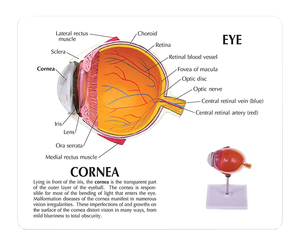 Modelo <span class=keywords><strong>de</strong></span> ojos para mostrar la ciencia médica, patología humana, para educación - Product Image 2