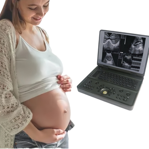 Dispositivo portátil médico do ultrassom de alta definição de Doppler, varredor de capacidade elevada do ultrassom do corpo humano do Portátil-tipo - Product Image 2