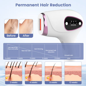 La Mejor Máquina Eléctrica para Depilación Facial, Depiladora Indolora, Dispositivo Portátil para Depilación, Afeitadora Facial y Corporal para Uso Doméstico para Mujeres - Product Image 5