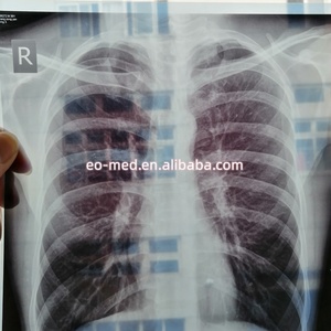 CE Approval Cheapest Price Digital X-ray Film Inkjet <b>Printer</b> With Split Cartridge XP02 - Product Image 6
