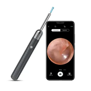 OEM ODM Perangkat Pembersih Perawatan Telinga Penggunaan Di Rumah Nirkabel 1080P HD Digital Otoscope Listrik Wifi Pembersih Kotoran Telinga dengan Kamera