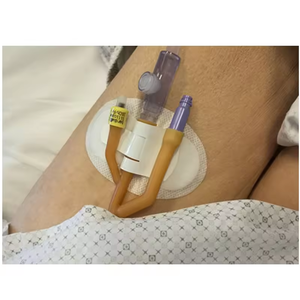 Pemegang tabung urin kateter Fixator antislip kolektor stabilisasi drainase canula fiksasi stiker kateter memperbaiki perangkat - Product Image 4