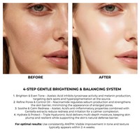 Soins de la peau en marque privée, contrôle du sébum, réduction des pores dilatés, des taches brunes, des rougeurs, acide azélaïque, niacinamide, anti-âge
