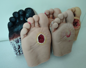 Modèle de pied diabétique en silicone de haute qualité avec ulcères purulents pour l'enseignement infirmier - Product Image 4