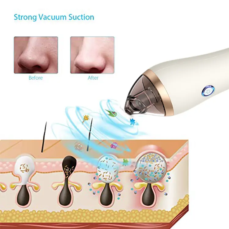 Electric Comedo Extractor Pore Cleaner Vacuum Suction Blackhead Heating Remover Blackheads Pimples Removal Deep Cleaning Tool