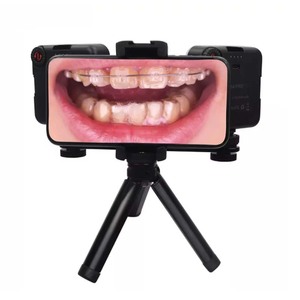 Meite équipement de photographie dentaire médicale lumière de remplissage prise de vue orale lumière de remplissage Flash photographie dentaire Flash - Product Image 1